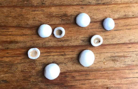 女子食用小龙虾竟剥出多颗陶瓷状珠子 专家提醒谨慎处理