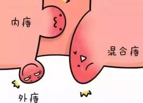 2025 消肉球痔疮药排名发布，TOP1竟靠这招让肉球萎缩