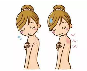 还在苦苦寻觅止痒快的湿疹膏？2025年十大品牌榜单给你答案